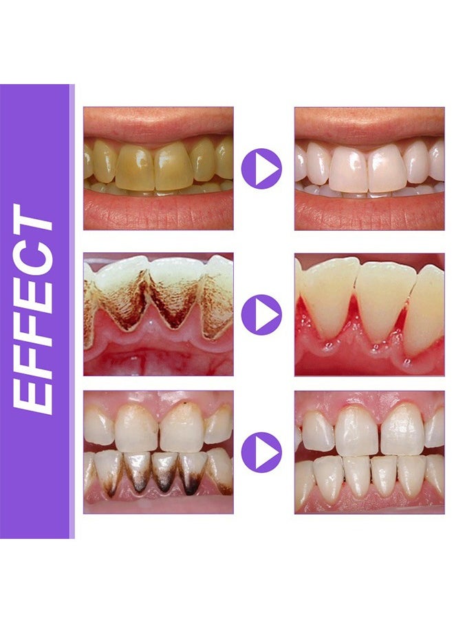 V34 Colour Corrector Foam - Teeth Whitening Tooth Colour Corrector Purple Toothpaste for Teeth Whitening Purple Teeth Whitening v34 Colour Correcting Foam Toothpaste Teeth Stain Removal