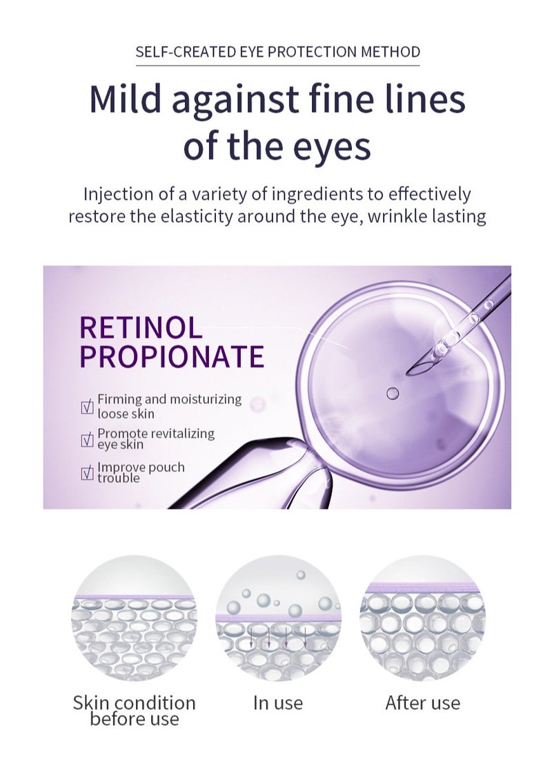 Retinol Eye Under Eye Cream with Cooling Roller, Eye Cream Anti Aging, Reduces Wrinkles Dark Circles and Puffy Eyes Bags, Brightening & Moisturizing Eye Repair Cream for all Skin Types