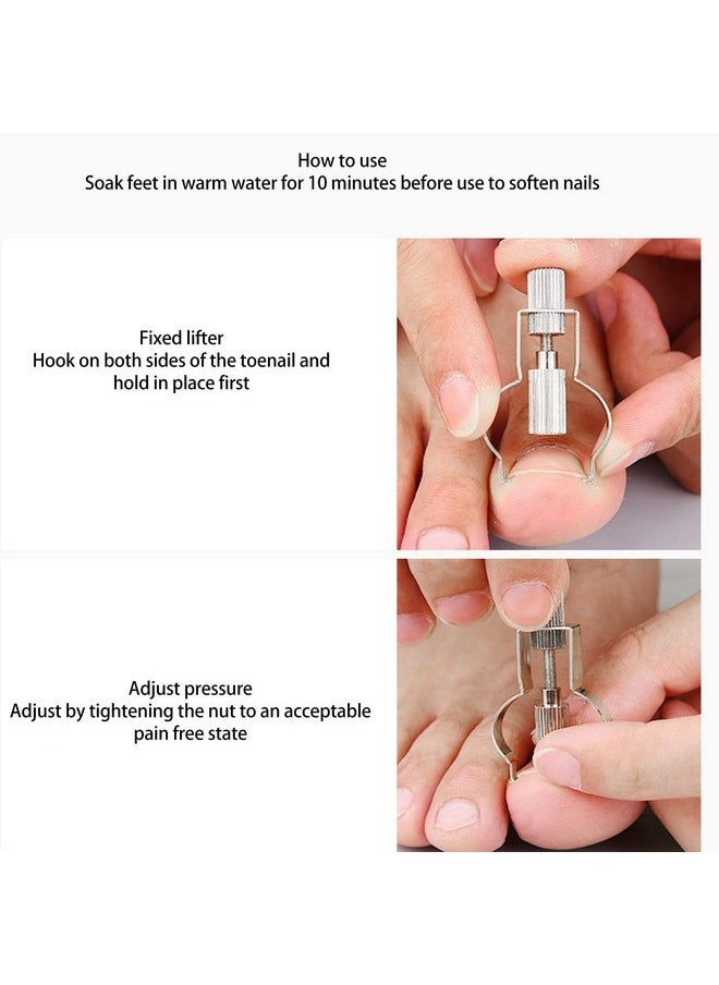 Toenail Lifter,Anggrek Stainless Steel Professional Foot Care Tool Toenail Clamp Ingrown Toenail Correction Lifter Stainless Steel Ingrown Toenail Lifter For Paronychia (Silver)