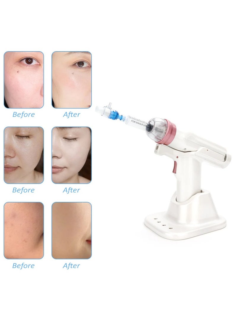 Hydrolifting Gun Mesotherapy EZ Negative Pressure Meso gun, Mesotherapy Hydrolifting Water Injector Microcrystal Injection