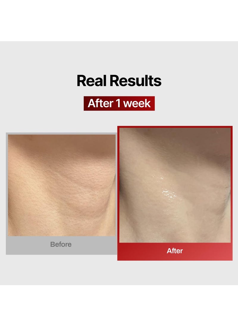 MEDITHERAPY Wrinkle-fit Mesh Sheet Neck Mask 7ea, Neck Wrinkle Patches, Collagen Treatment for Tightening, Firming, and Lifting, Anti-Wrinkle Wrap, Line Remover