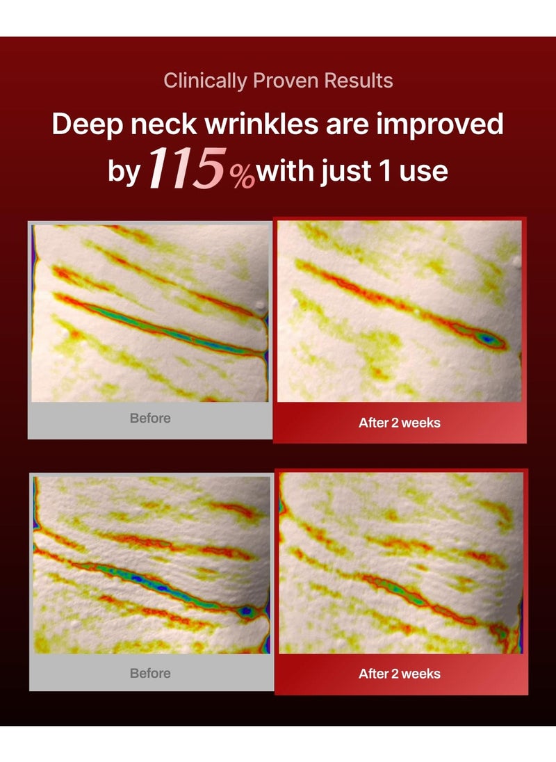 MEDITHERAPY Wrinkle-fit Mesh Sheet Neck Mask 7ea, Neck Wrinkle Patches, Collagen Treatment for Tightening, Firming, and Lifting, Anti-Wrinkle Wrap, Line Remover