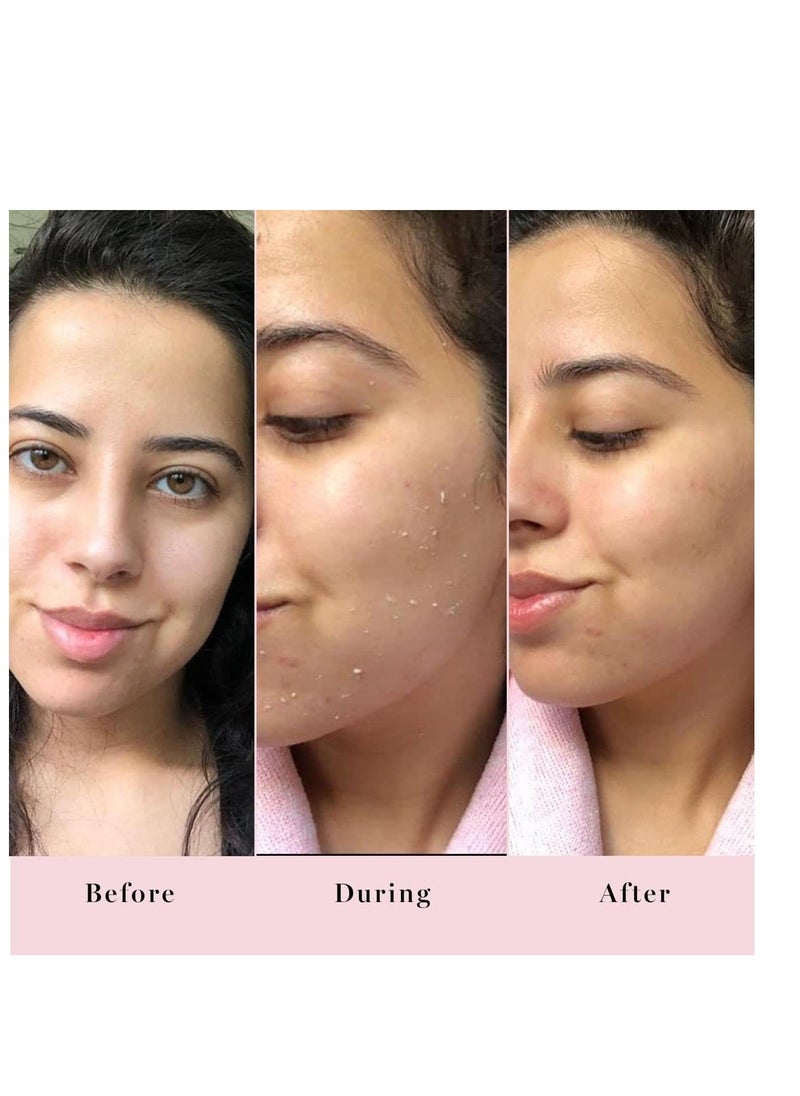 Saturday Skin Rub-A-Dub Refining Peel Gel Facial Cleansing Gels Facial Cleansing Washes Natural Fruit Enzymes Gel Mild Cleanser Exfoliating Gel Great for sensitive skin (2.53 Fl. Oz. (75ml))