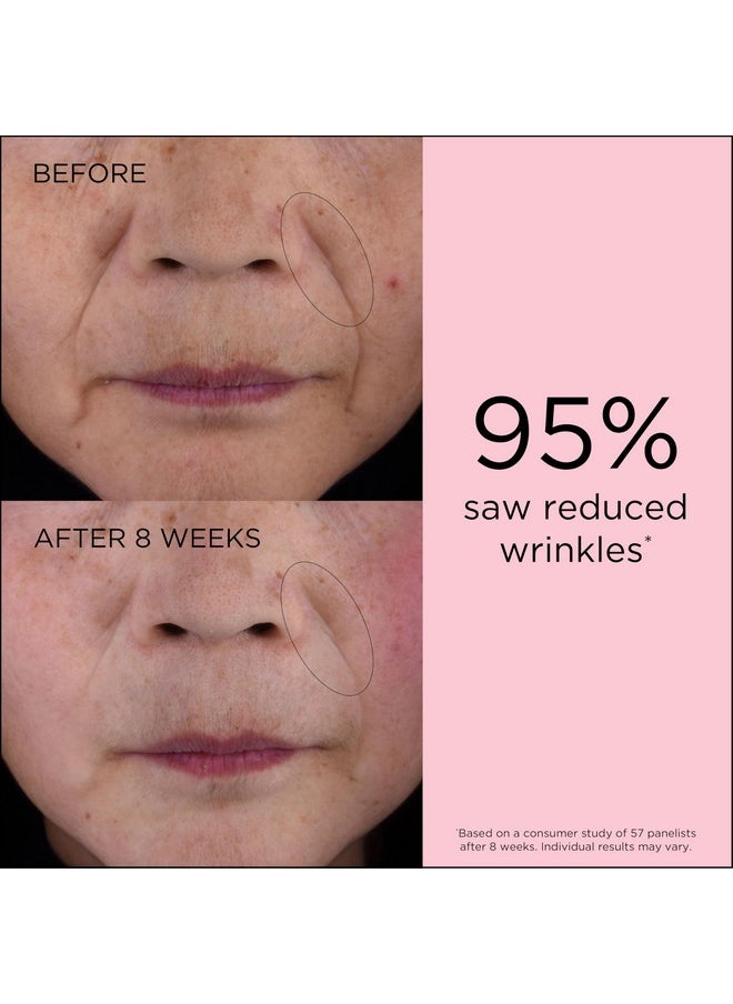 Retinol + Hpr Ceramide Capsules, Anti-Aging Skin Renewing Serum, Skincare Gift For Women, Reduces Fine Lines & Wrinkles