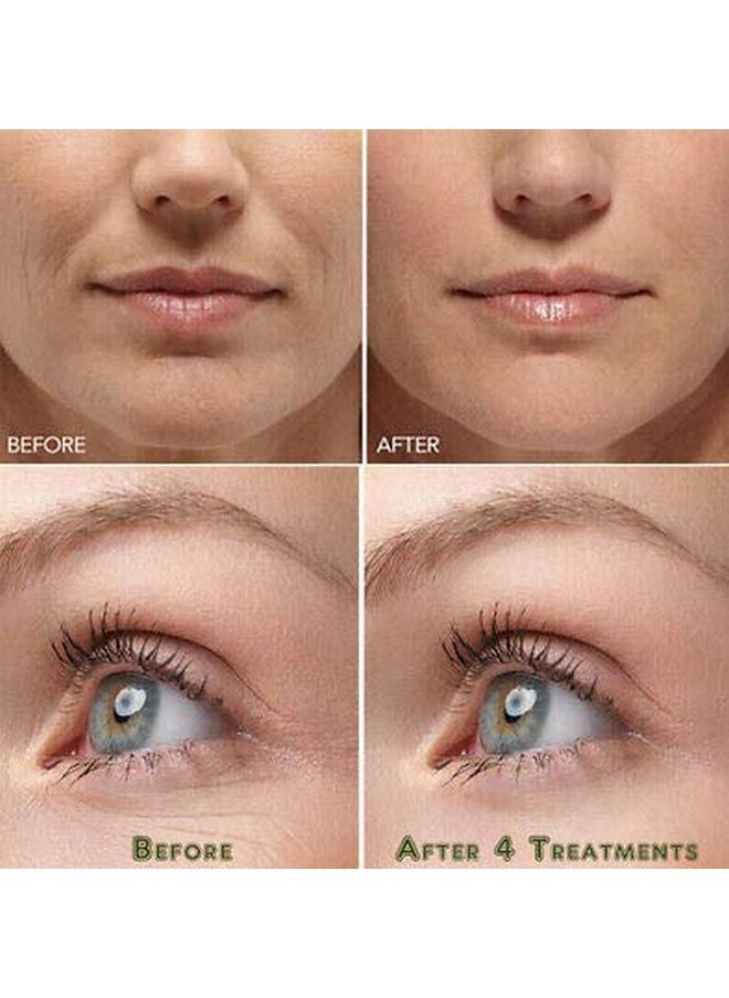 Hyaluronic Acid Powder Lowest Molecular Size Below10 Kda Hyaluronic Better Penetration In Skin Layers - 50 G