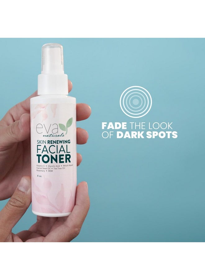 Witch Hazel Toner For Face - Facial Toner For Dry Skin - Skin Toner For Women - Toner For Acne Prone Skin - Face Toner For Oily Skin - All Skin Types Hydrating Toner For Face And Sensitive Skin (4Oz)