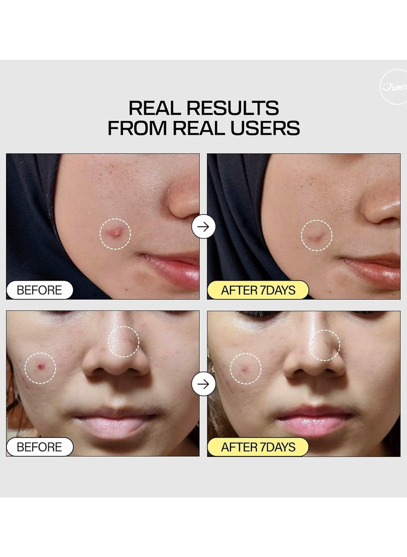 JUMISO Snail Mucin 95% Peptide Essence 140ml | Hydrating Serum with Snail, Face Moisturizer for Dry Skin, Daily Deep Hydration | Non-comedogenic, Fragrance-free, Cruelty-free, Korean Skincare | 4.73 fl oz, 140ml.