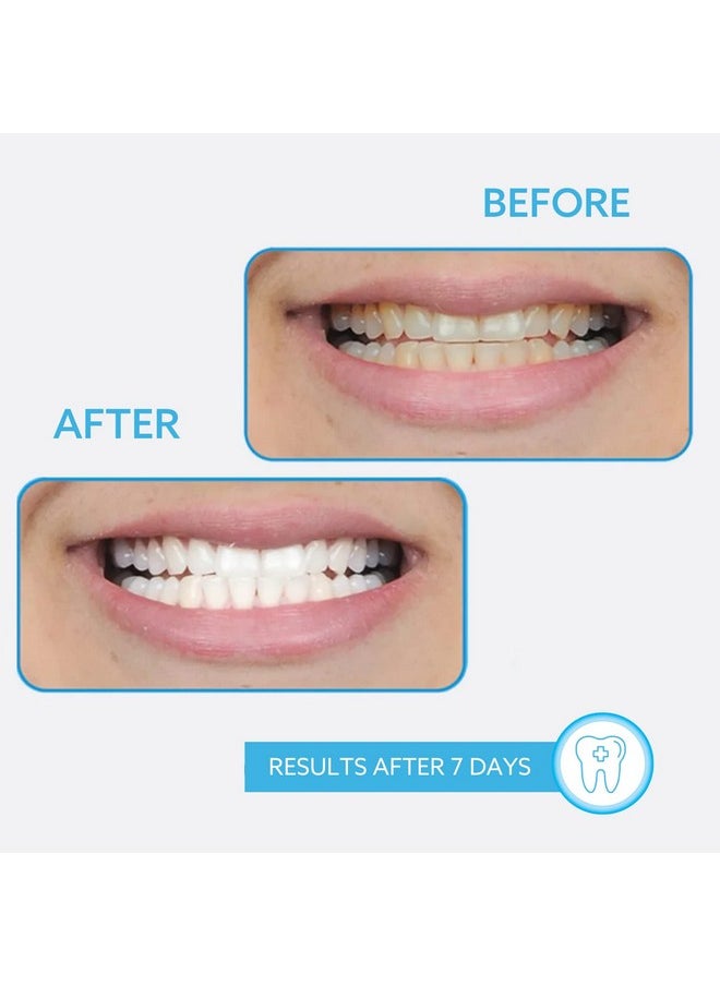 On The Go Teeth Whitening (Whitening Pen (2 Pack)