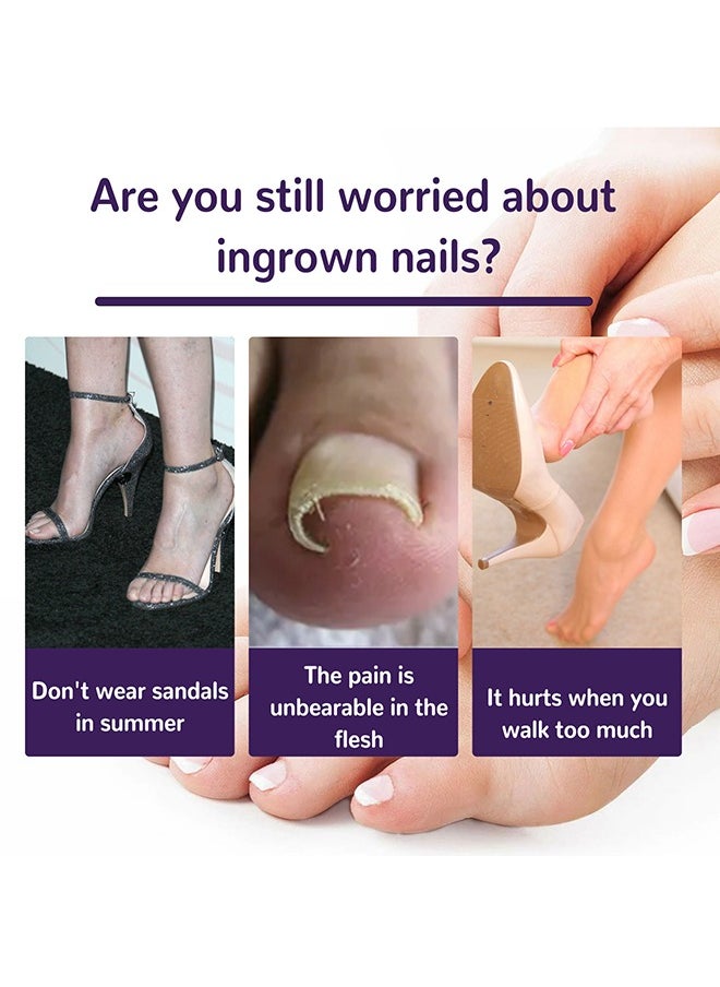 Ingrown Toenail Corrector Patch,Ingrown Toenail Corrector Strips, Toenail Corrector Patch,Self-Adhesive Elastic Toenail Correction Stickers Tool,Relieves Ingrown Toenail Groove Pain(50Pcs)