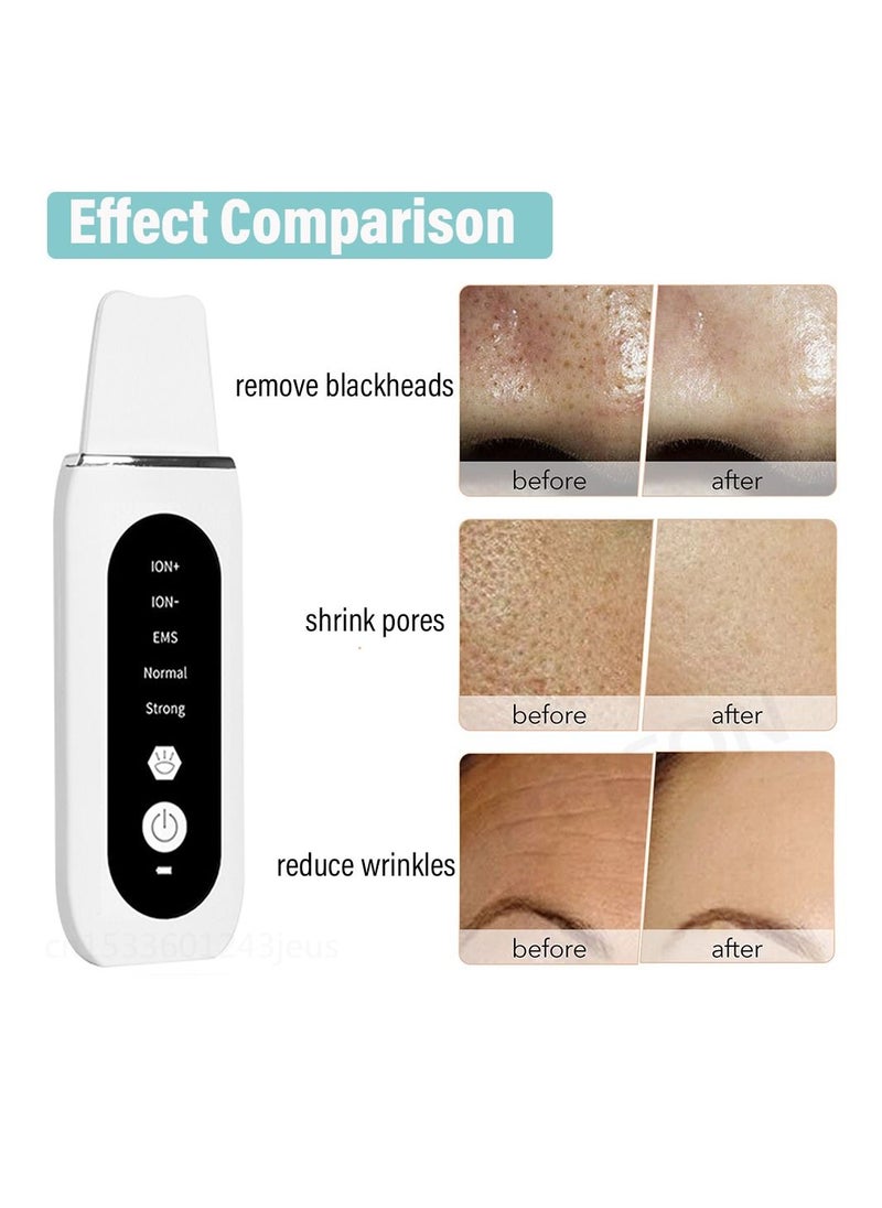 Ultrasonic Skin Scrubber Peeling Blackhead Remover Deep Face Cleaning Ultrasonic Ion Ance Pore Cleaner Facial Shovel Cleanser