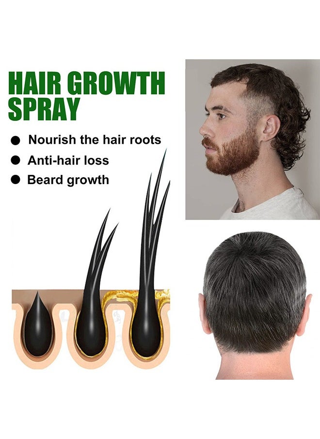 Hair Growth Spray，Fast Hair Growth Spray Serum Ginger Anti Hair Loss Treatment Product Prevent Thinning Dry Frizzy Repair Beauty Hair Care Essence