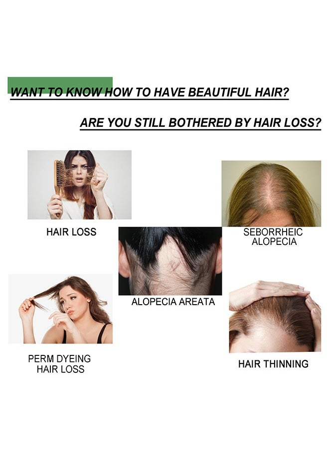 Hair Growth Spray，Fast Hair Growth Spray Serum Ginger Anti Hair Loss Treatment Product Prevent Thinning Dry Frizzy Repair Beauty Hair Care Essence