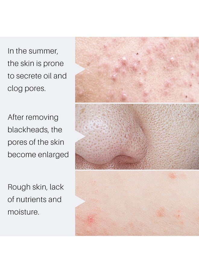 Removal of Acne, Oil Control Acne Removing Cleanser, Gentle care, clean skin dirt, skin fine and smooth, smooth and soft, soft skin after use, Anti Acne Treatment Facial Cleanser 100g