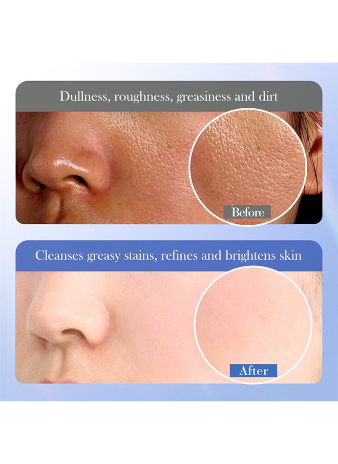 Removal of Acne, Oil Control Acne Removing Cleanser, Gentle care, clean skin dirt, skin fine and smooth, smooth and soft, soft skin after use, Anti Acne Treatment Facial Cleanser 100g