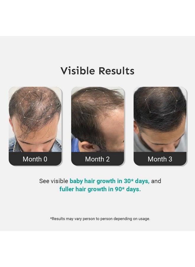 Intensive Hair Growth Serum With 3% Redensyl, 3% Procapil, Onion, Turmeric, Rice Water | Controls Hair Fall, Stimulates Hair Growth, Increases Hair Density | Hair Growth Serum For Men & Women | Pack Of 3 (90Ml)