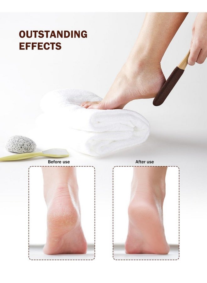 Foot Pumice Stone Pedicure File(1 Pcs) - Ergonomic Wooden Handle Foot File Callus Remover For Smoother Feet And Hands - Foot Scrubber, Heel Sander And Dead Skin Scraper - Brown