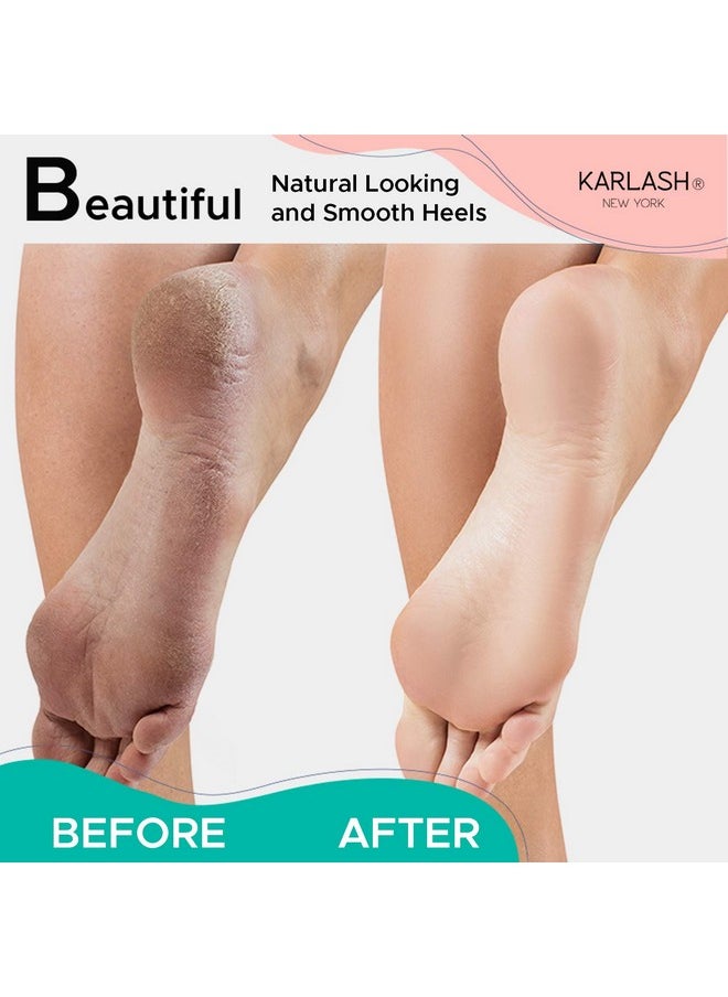 Professional Pedicure Foot Pumice Stone For Feet Skin Callus Remover And Scrubber For Dead Skins 2 Sided (Pack Of 4)