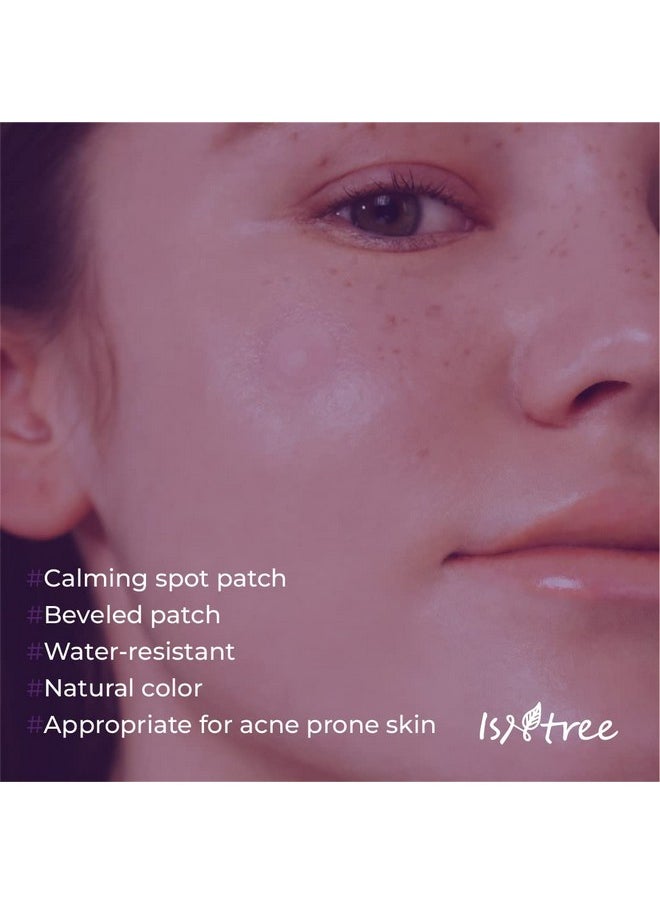 Onion Newpair Pimple Patch Basic (24 Patches) Patches In 2 Sizes | Blemish Care | Spot Care | Water-Resistant For Daily Use