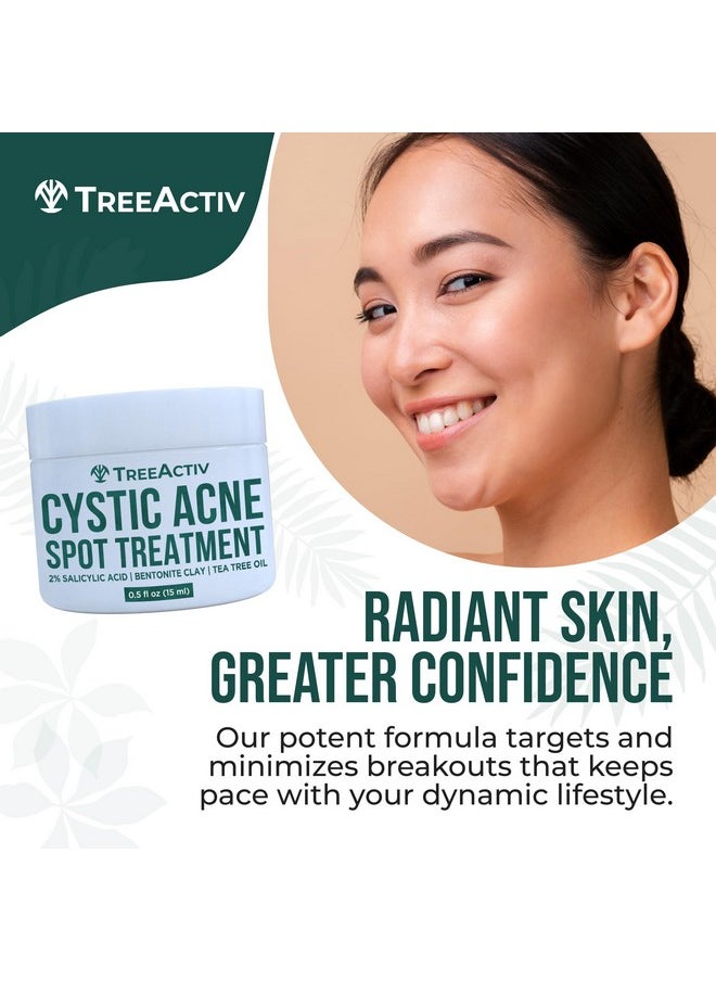 Salicylic Acid Cystic Acne Spot Treatment, 0.5 Fl Oz, Acne Treatment For Face, Acne Spot Cream, Hormonal Acne Treatment, Acne Spot Treatment For Face And Body, Acne Cream For Teens & Adults