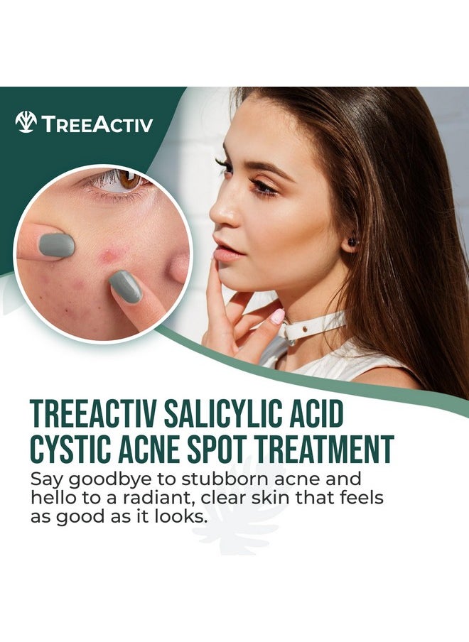Salicylic Acid Cystic Acne Spot Treatment, 0.5 Fl Oz, Acne Treatment For Face, Acne Spot Cream, Hormonal Acne Treatment, Acne Spot Treatment For Face And Body, Acne Cream For Teens & Adults