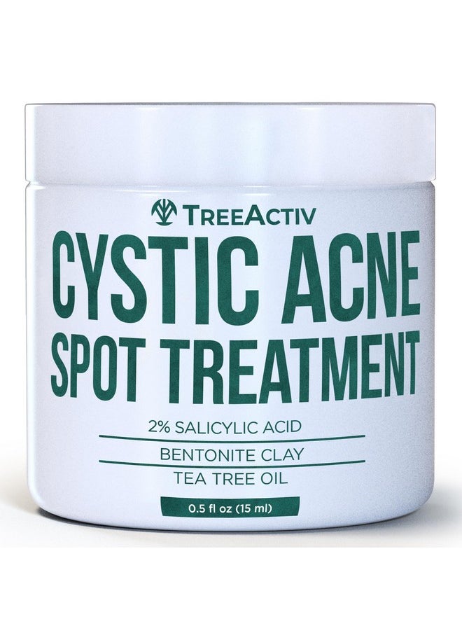 Salicylic Acid Cystic Acne Spot Treatment, 0.5 Fl Oz, Acne Treatment For Face, Acne Spot Cream, Hormonal Acne Treatment, Acne Spot Treatment For Face And Body, Acne Cream For Teens & Adults