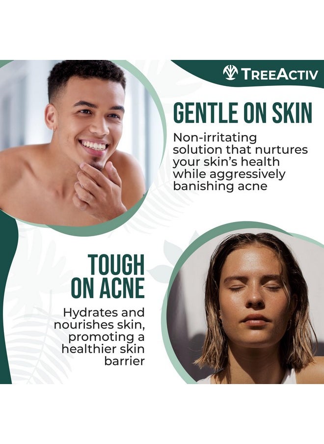 Salicylic Acid Cystic Acne Spot Treatment, 0.5 Fl Oz, Acne Treatment For Face, Acne Spot Cream, Hormonal Acne Treatment, Acne Spot Treatment For Face And Body, Acne Cream For Teens & Adults