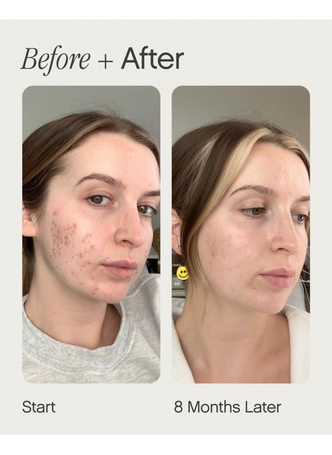 Topicals Faded Brightening and Clearing Serum | Reduces Discoloration, Post-Blemish Marks, Scars and Spots | Contains Kojic Acid and Niacinamide | Dermatologist-tested, Vegan, Cruelty-Free (1.7 Fl Oz)
