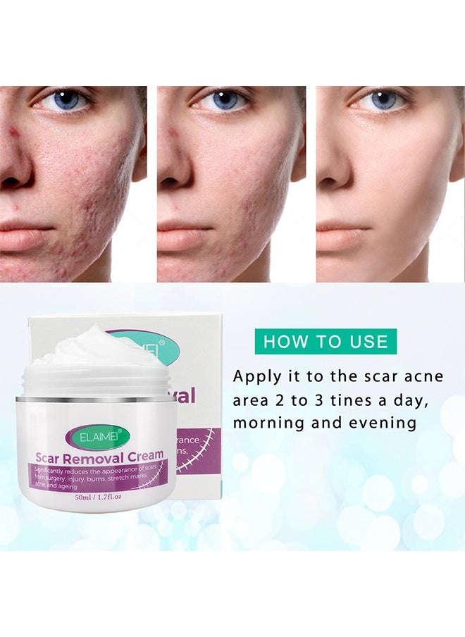 Scar Removal Cream, Significantly reduces the appearance of scars from surgery,injury,burns,stretch marks,acne,and ageing,Fade Scald Scar Surgical Repair Cream, Scar Cream for scald Caesarean section scar cream for surgery scar cream 50ml