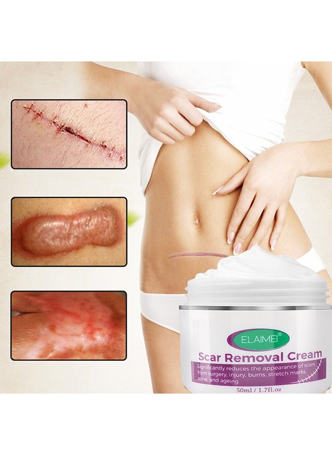 Scar Removal Cream, Significantly reduces the appearance of scars from surgery,injury,burns,stretch marks,acne,and ageing,Fade Scald Scar Surgical Repair Cream, Scar Cream for scald Caesarean section scar cream for surgery scar cream 50ml