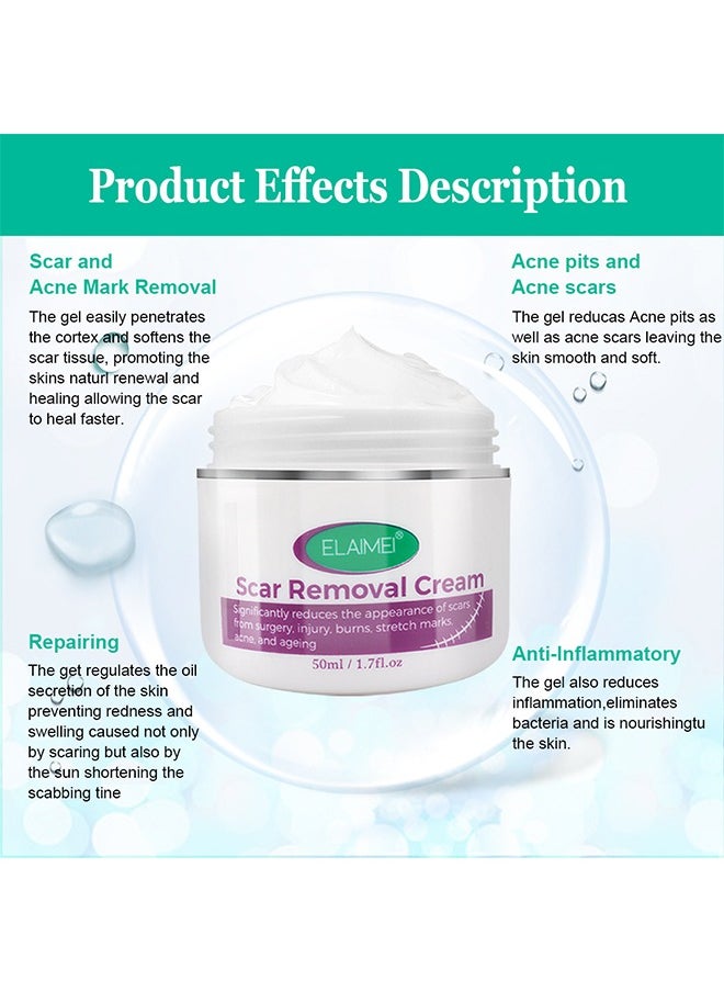 Scar Removal Cream, Significantly reduces the appearance of scars from surgery,injury,burns,stretch marks,acne,and ageing,Fade Scald Scar Surgical Repair Cream, Scar Cream for scald Caesarean section scar cream for surgery scar cream 50ml