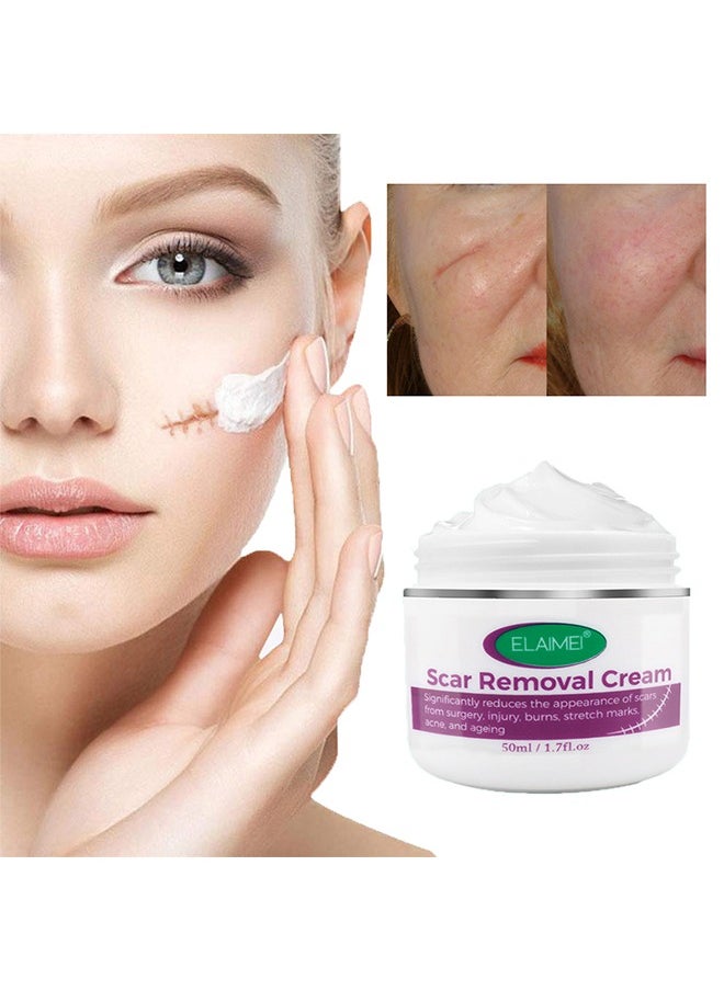 Scar Removal Cream, Significantly reduces the appearance of scars from surgery,injury,burns,stretch marks,acne,and ageing,Fade Scald Scar Surgical Repair Cream, Scar Cream for scald Caesarean section scar cream for surgery scar cream 50ml