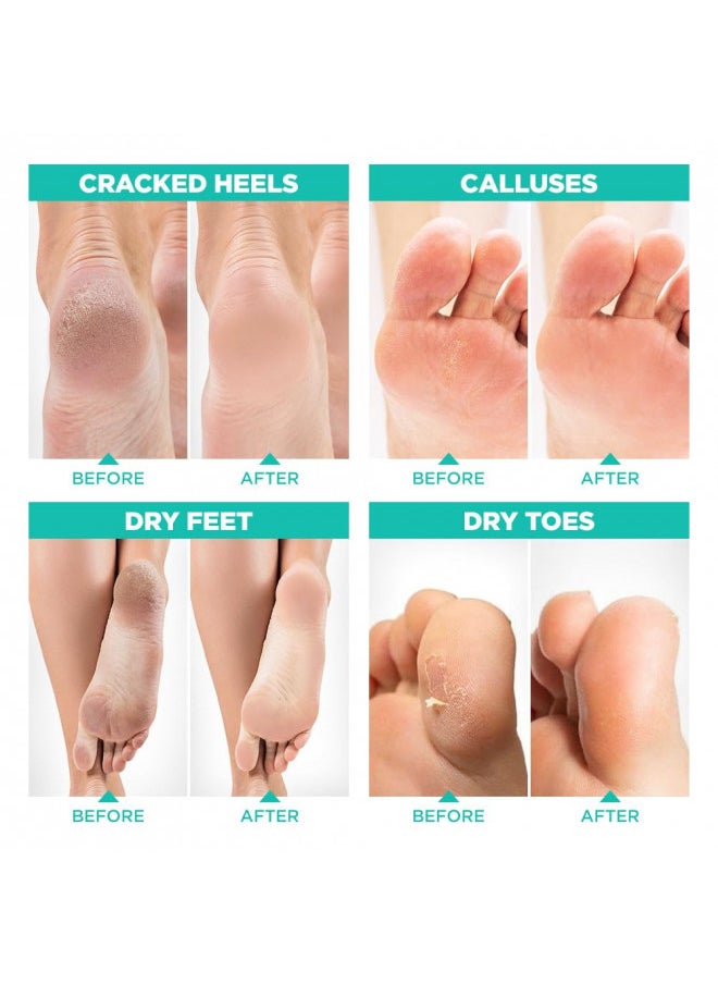 Lavinso Foot Peel Mask for Dry Cracked Feet 3 Pack Dead Skin Remover Foot Mask for Cracked Feet and Callus - Exfoliating Feet Peeling Mask for Soft Baby Feet, Original Scent