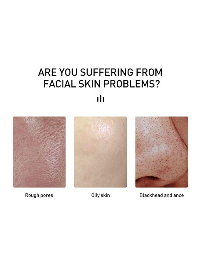 Salicylic Acid Acne Treatment Cream, Acne Treatment Prevent Breakouts, Face Cream Whitening Facial Treatment Hyaluronic Acid Black Dots Remove Skin Care Beauty Health, Hydrating and Repairing Sensitive Skin Moisturizing Base Serum 15ml