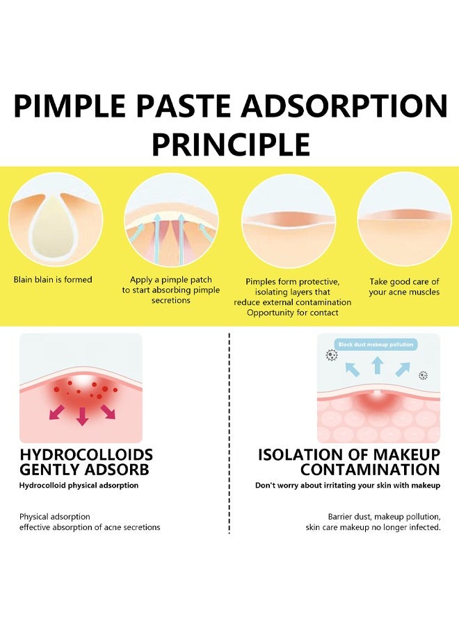 Hydrocolloid Acne Patches- with Tea Tree Oil Pimple Patches for Face Zit Patch and Pimple Stickers Hydrocolloid Acne Dots for Healing Acne with Zit Patches 10 Patches