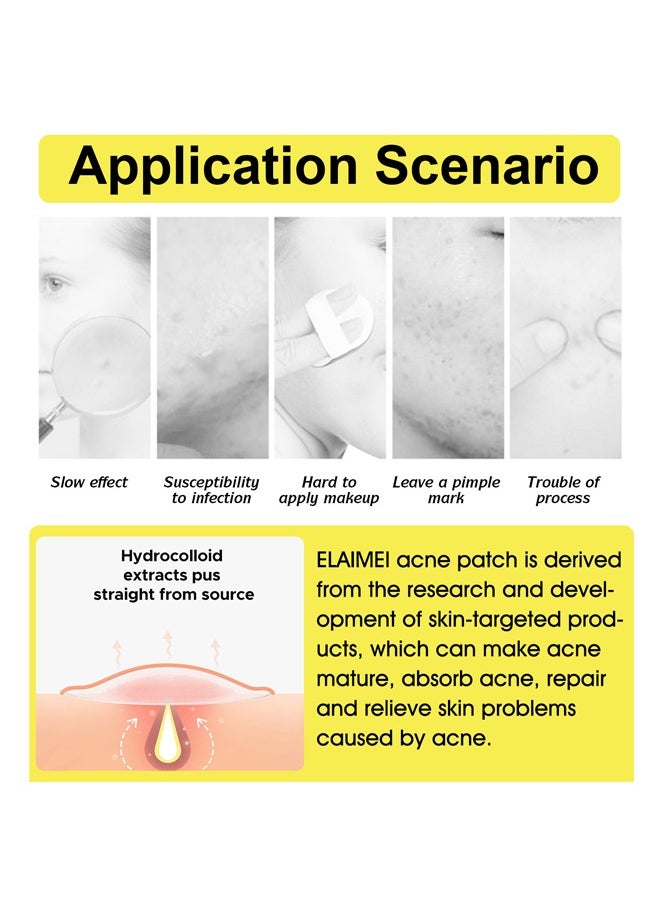 Hydrocolloid Acne Patches- with Tea Tree Oil Pimple Patches for Face Zit Patch and Pimple Stickers Hydrocolloid Acne Dots for Healing Acne with Zit Patches 10 Patches