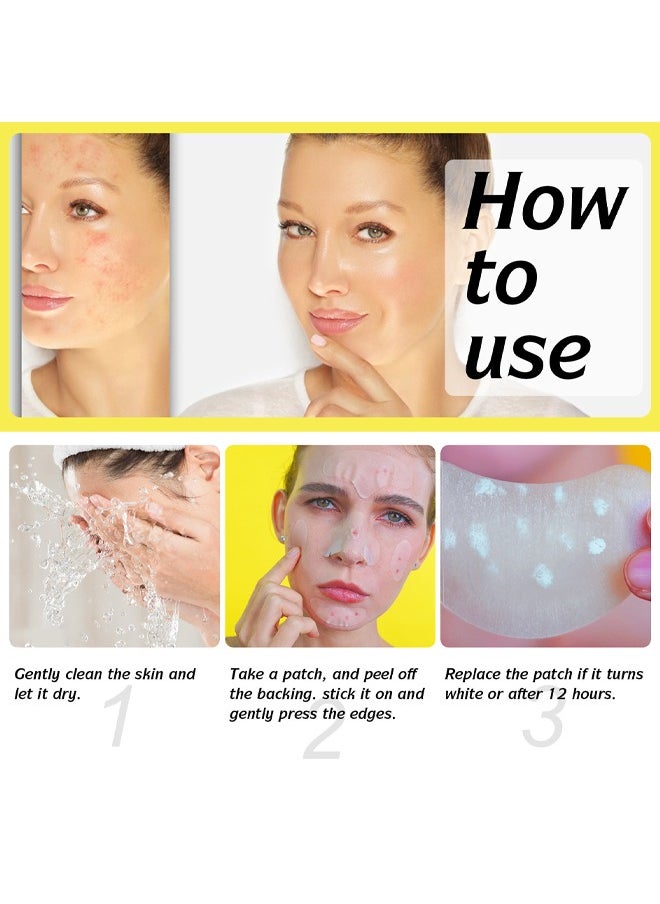 Hydrocolloid Acne Patches- with Tea Tree Oil Pimple Patches for Face Zit Patch and Pimple Stickers Hydrocolloid Acne Dots for Healing Acne with Zit Patches 10 Patches