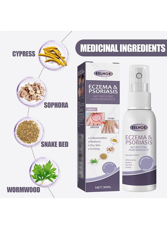 Eczema and Psoriasis Non-Steroidal 100% Natural Relief，Atomizing Spray 30ml, Hand and Foot Moss Skin Repair, Relieve Itching, Skin care and Jiejia spray, Antibacterialnot Irritating Safety