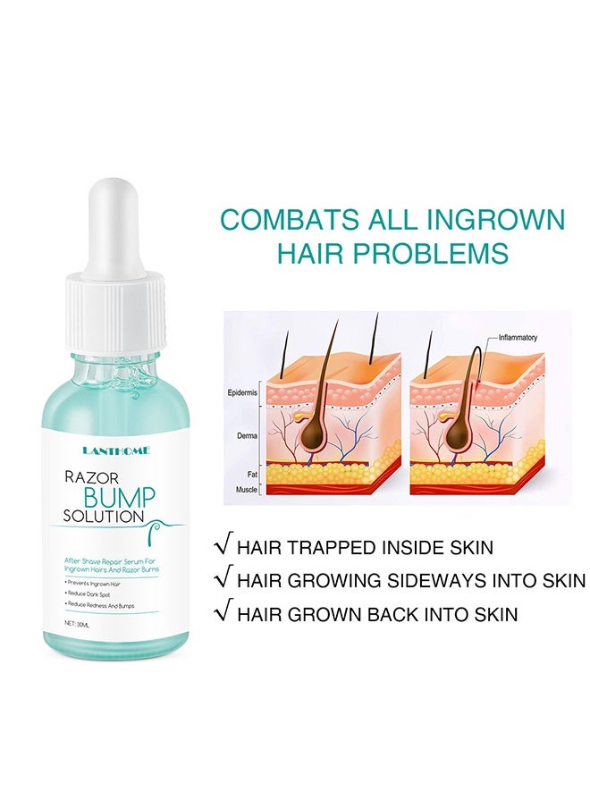 Razor Bump Solution,Hair Growth Inhibitor Safe and Gentle Repair serum, Delay Hair Growth, No Black Spots 30ml