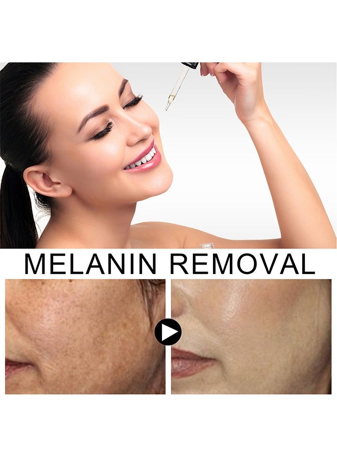 Melanin Removal Skin Balance Serum，Niacinamide Serum, Face Whitening Dark Spot Corrector Serum, Whitening And Moisturizing Anti Aging Face Cream, Smooth Gentle Brightening Skin Care Serum For Skin Repairing