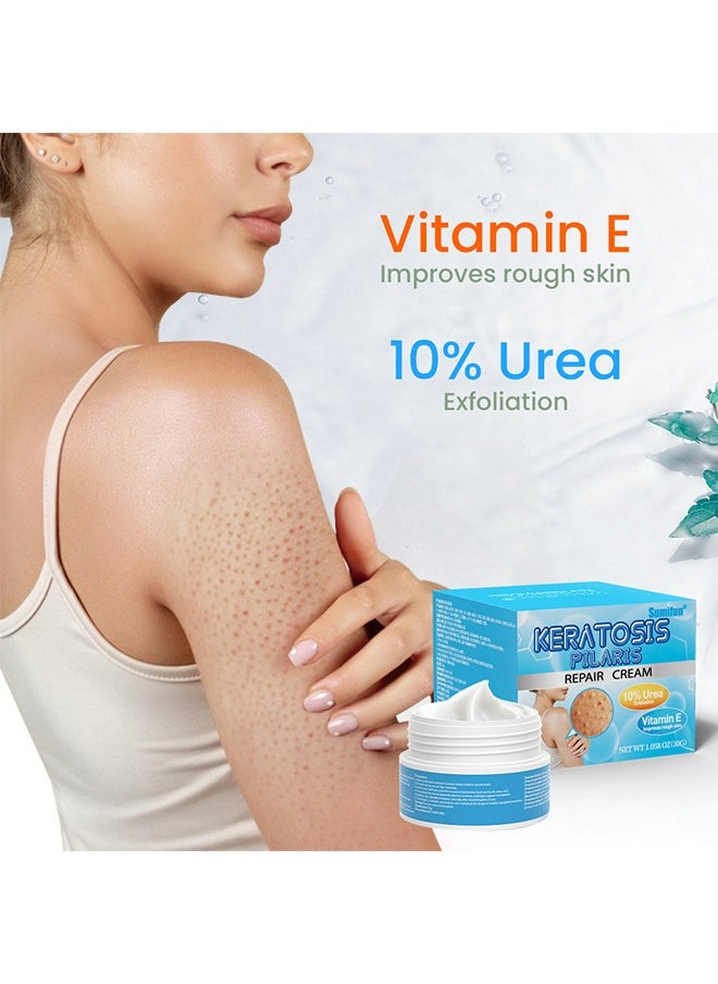 Keratosis Pilaris Repair Cream,Vitamin E cream, urea to remove dead skin cells 30g