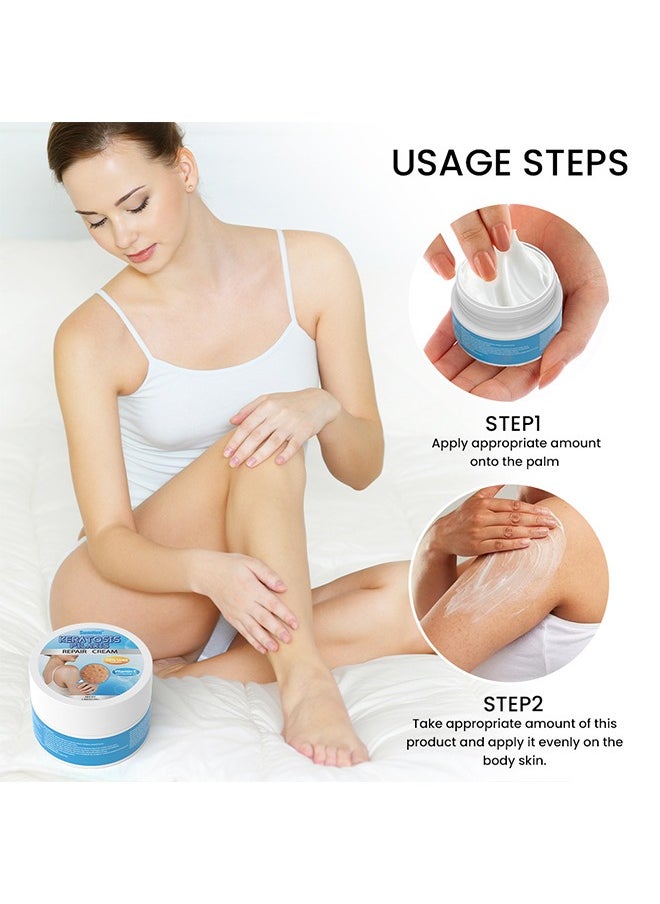 Keratosis Pilaris Repair Cream,Vitamin E cream, urea to remove dead skin cells 30g