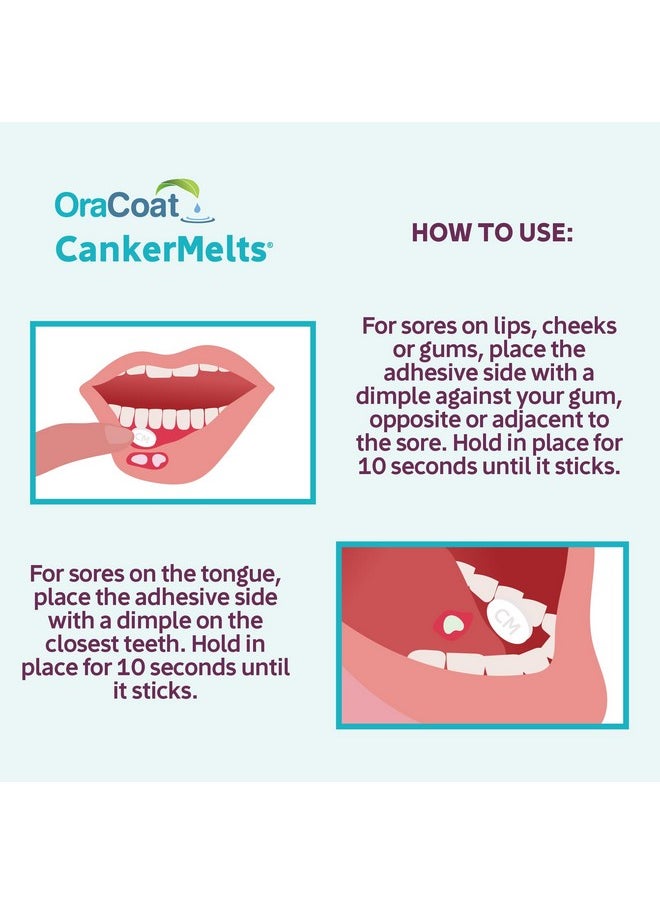 ® Cankermelts® Stick-On Melts™ Mouth Sore Treatment, 20 Count