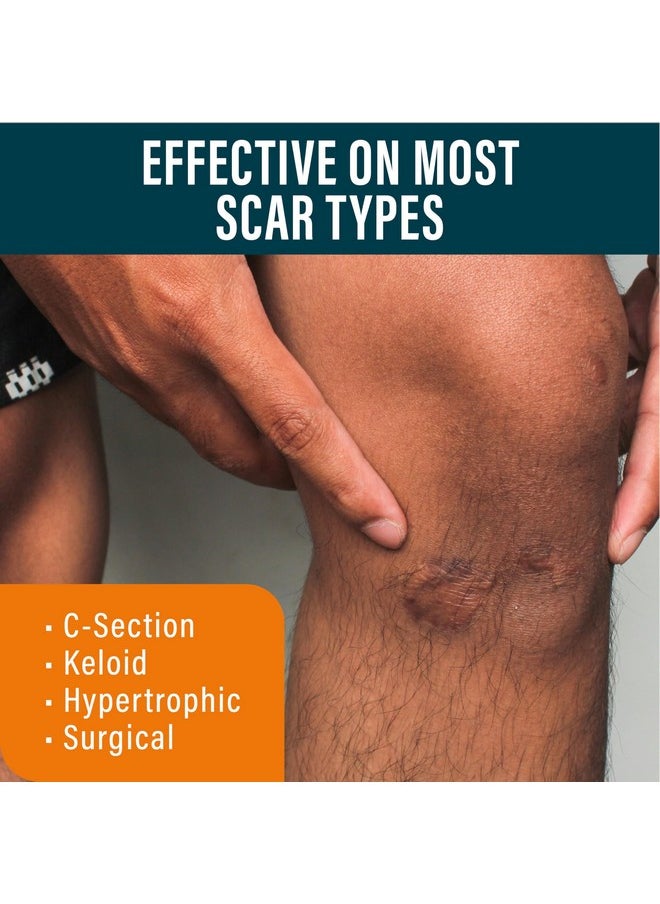 Scar Gel - W/Retinol, Allantoin, Vitamin E, & Betaine - Scar Treatment For C-Section, Tummy Tuck, & Keloid Scars - 1.7 Oz Pump Bottle For Post-Surgery Care - 2 Pack Silicone Gel For Scars