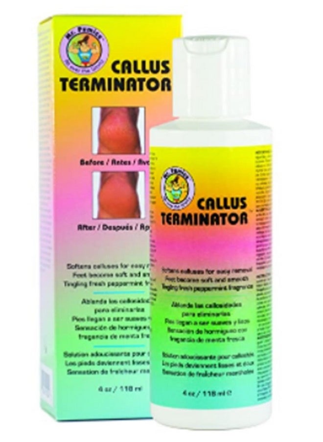 Callus Terminator 4Oz