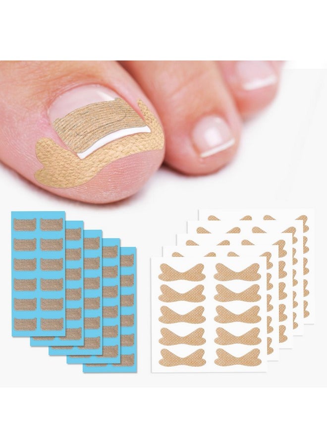 60Pcs Breathable Ingrown Toenail Corrector Patches And 50Pcs Ingrown Toenail Stickers - Professional Ingrown Toe Nail Treatment Tape For Pain Relief And Correction