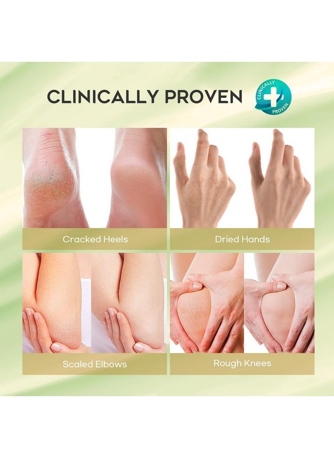 Urea Cream 42% Foot Cream Salicylic Acid 4 Oz, Upgraded Callus Remover For Feet, Knees& Elbows, Intensive Moisturizes & Softens Skin, Exfoliates Dead Skin