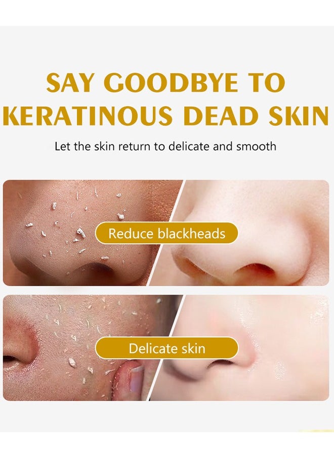 Peeling Gel - Face Exfoliator Lemon Sparkling Peeling Gel Brightening Facial Exfoliator Deep Exfoliating Face Exfoliator Exfoliating Peeling Gel Gently Daily Exfoliates For All Skin Types 100ml
