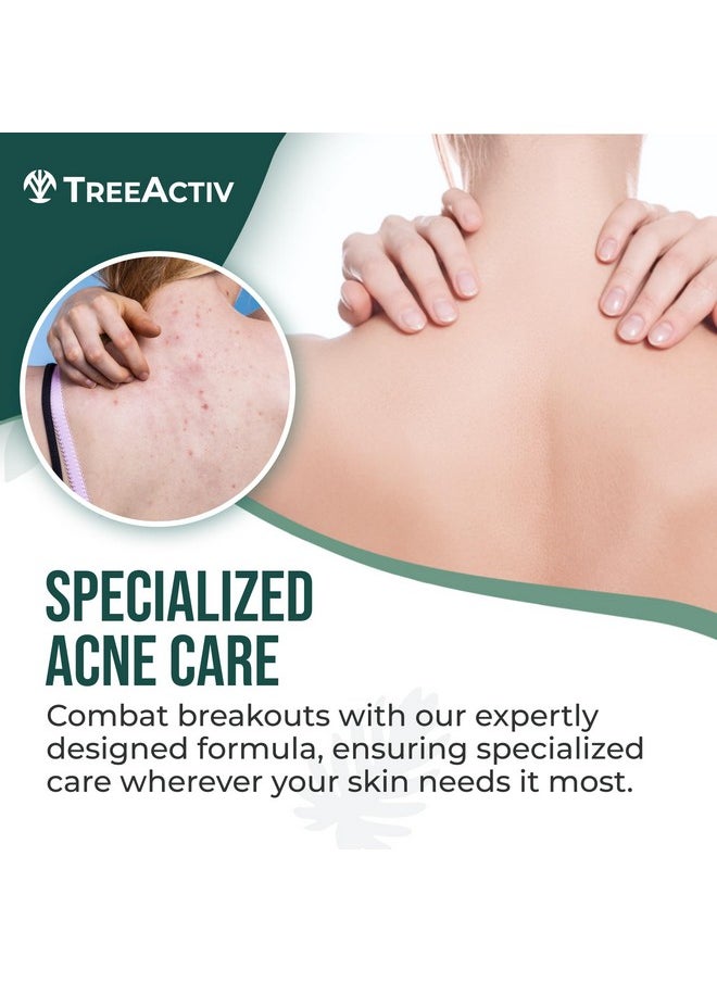 Body Acne Treatment Spray 4 Fl Oz, 2% Salicylic Acid Spray, Back Acne Spray, Tea Tree Oil Spray With Aloe Vera, Body Acne Spray, Back Acne Solution, Butt Acne Clearing Treatment, 1000+ Uses