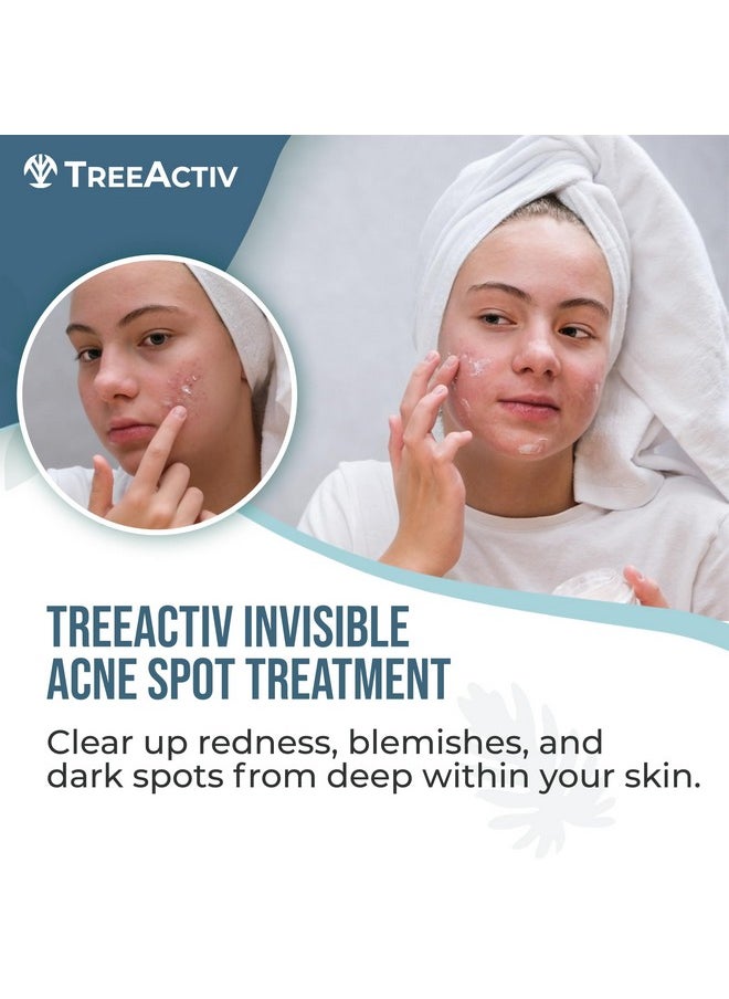 Invisible Acne Spot Treatment, 150+ Treatments, Salicylic Acid & Tea Tree Oil No Show Spot Treatment For Cystic & Hormonal Acne, Works For Blackheads & Whiteheads