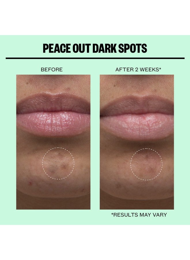 Skincare Dark Spots. Dissolving Microstructure Dots To Reduce The Appearance Of Dark Spots & Hyperpigmentation, Niacinamide Helps Reveal Clear, Even Skin (12 Dots)